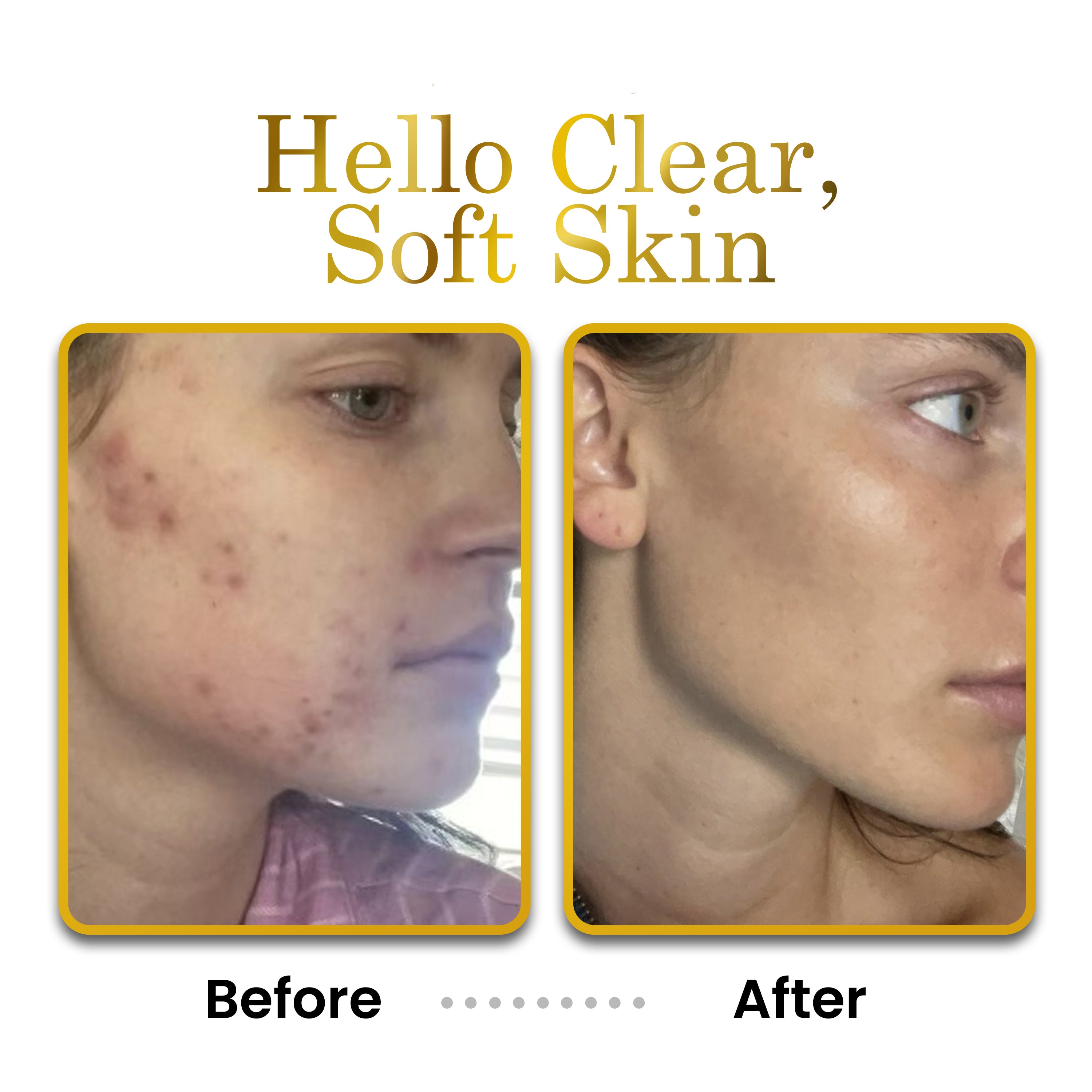 Before and after comparison of skin with &