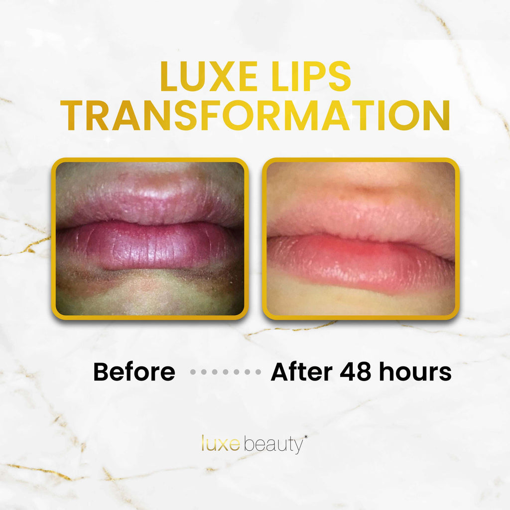 Beeswax Free, Nut Free Lip Balm - Luxe Lips - Wacky Watermelon