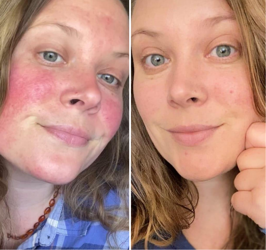 Dry Skin Repair Routine