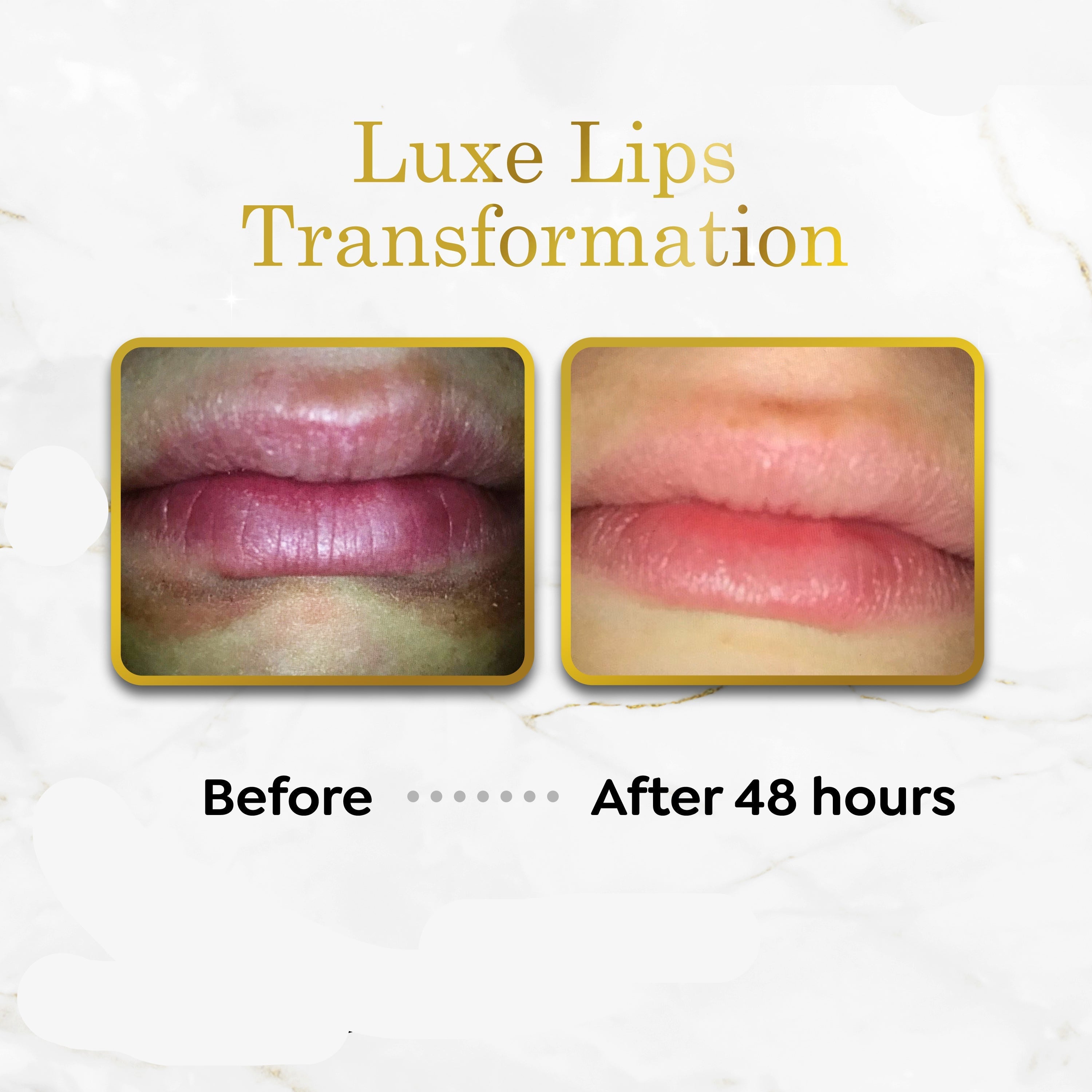 Luxe Lips - Beeswax Free, Nut Free Lip Balm - Vanilla Cupcake