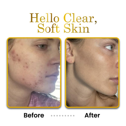 Before and after comparison of skin with &