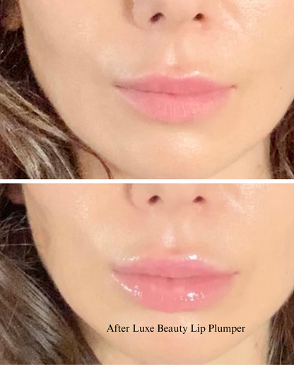Before and after comparison of lips using Luxe Beauty Lip Plumper