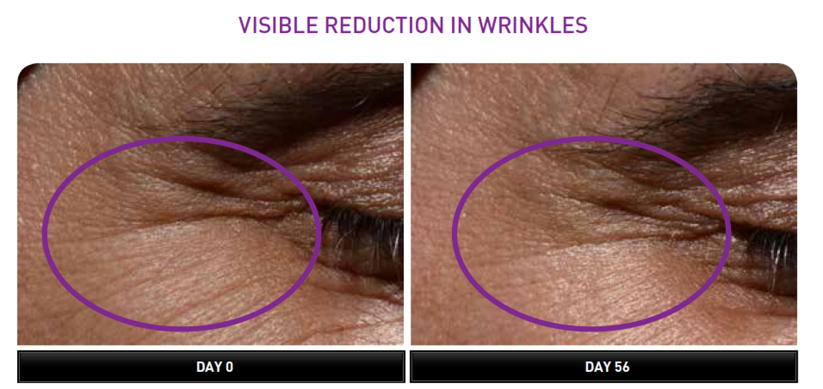 Anti-Aging System for Wrinkles &amp; Fine Lines