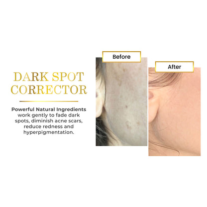 Before and after comparison of dark spot corrector on skin with text about Luxe Beauty Lighten &amp; Brighten Serum  benefits.