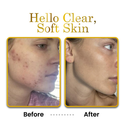Before and after comparison of Luxe Beauty Face, Neck &amp; Hand Moisturizer Cleanser skin with &